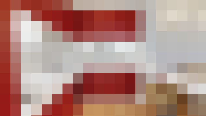 / #7